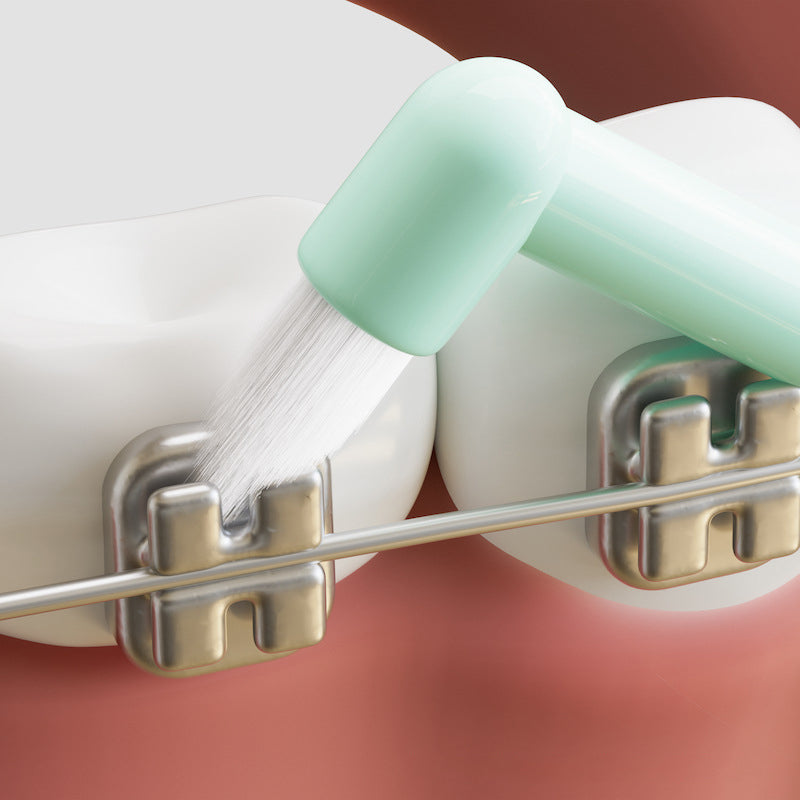 How to clean teeth with braces?