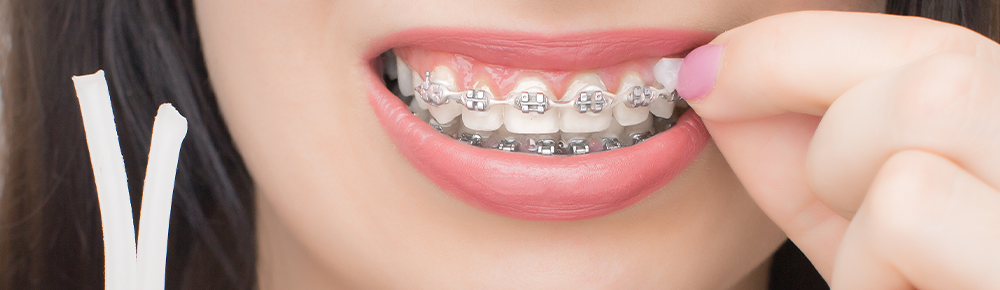 How to use braces wax?